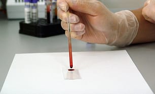 lab test